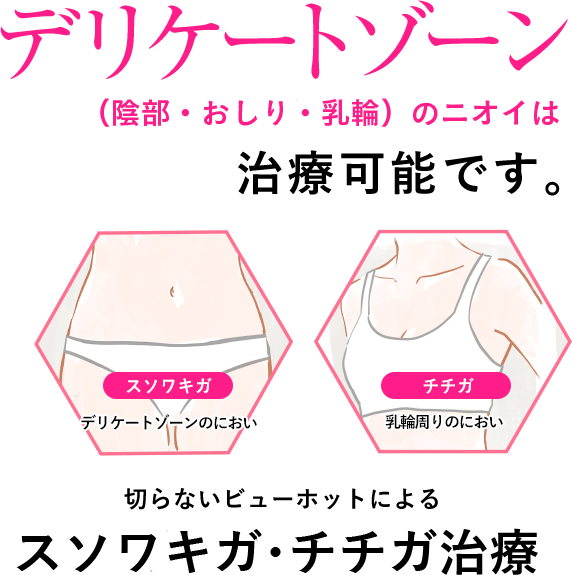 デリケートゾーンのニオイは治療可能です。切らないビューホットによるチチガ・スソワキガ治療